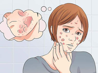 面部患痤疮的形成原因是哪些